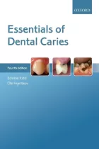 Product cover for Essentials of Dental Caries