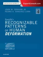Product cover for Smith's Recognizable Patterns of Human Deformation E-Book