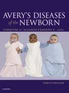 Product cover for Avery&#039;s Diseases of the Newborn E-Book