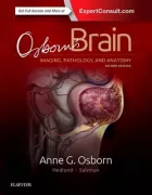 Product cover for Osborn's Brain