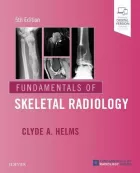 Product cover for Fundamentals of Skeletal Radiology