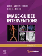 Product cover for Image-Guided Interventions E-Book