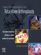Product cover for Technique of Total Knee Arthroplasty