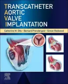 Product cover for Transcatheter Aortic Valve Implantation