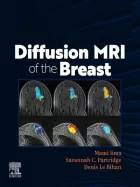 Product cover for DIFFUSION MRI OF THE BREAST