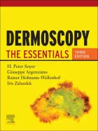Product cover for Dermoscopy