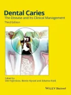 Product cover for Dental Caries