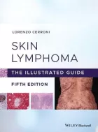 Product cover for Skin Lymphoma