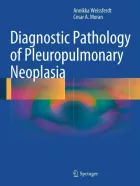 Product cover for Diagnostic Pathology of Pleuropulmonary Neoplasia