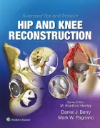Product cover for Illustrated Tips and Tricks in Hip and Knee Reconstructive and Replacement Surgery
