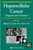 Product cover for Hepatocellular Carcinoma