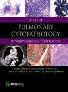 Product cover for Atlas of Pulmonary Cytopathology