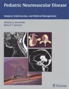 Product cover for Pediatric Neurovascular Disease