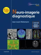Product cover for Neuro-imagerie diagnostique