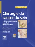 Product cover for Chirurgie du cancer du sein