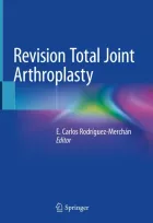 Product cover for Revision Total Joint Arthroplasty