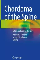 Product cover for Chordoma of the Spine