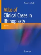 Product cover for Atlas of Clinical Cases in Rhinoplasty