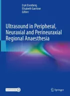 Product cover for Ultrasound in Peripheral, Neuraxial and Perineuraxial Regional Anaesthesia