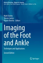 Product cover for Imaging of the Foot and Ankle