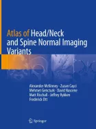 Product cover for Atlas of Head/Neck and Spine Normal Imaging Variants