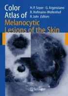 Product cover for Color Atlas of Melanocytic Lesions of the Skin