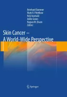 Product cover for Skin Cancer - A World-Wide Perspective