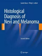 Product cover for Histological Diagnosis of Nevi and Melanoma