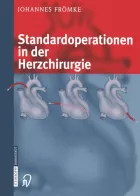 Product cover for Standardoperationen in der Herzchirurgie