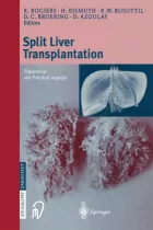 Product cover for Split liver transplantation