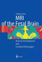 Product cover for MRI of the Fetal Brain