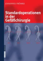Product cover for Standardoperationen in der Gefäßchirurgie