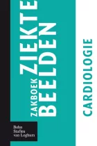 Product cover for Zakboek ziektebeelden Cardiologie