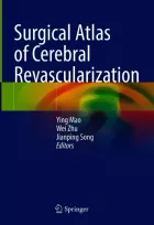 Product cover for Surgical Atlas of Cerebral Revascularization